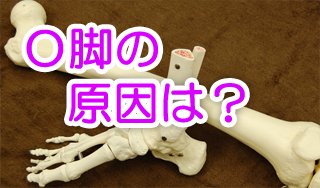 O脚原因は?